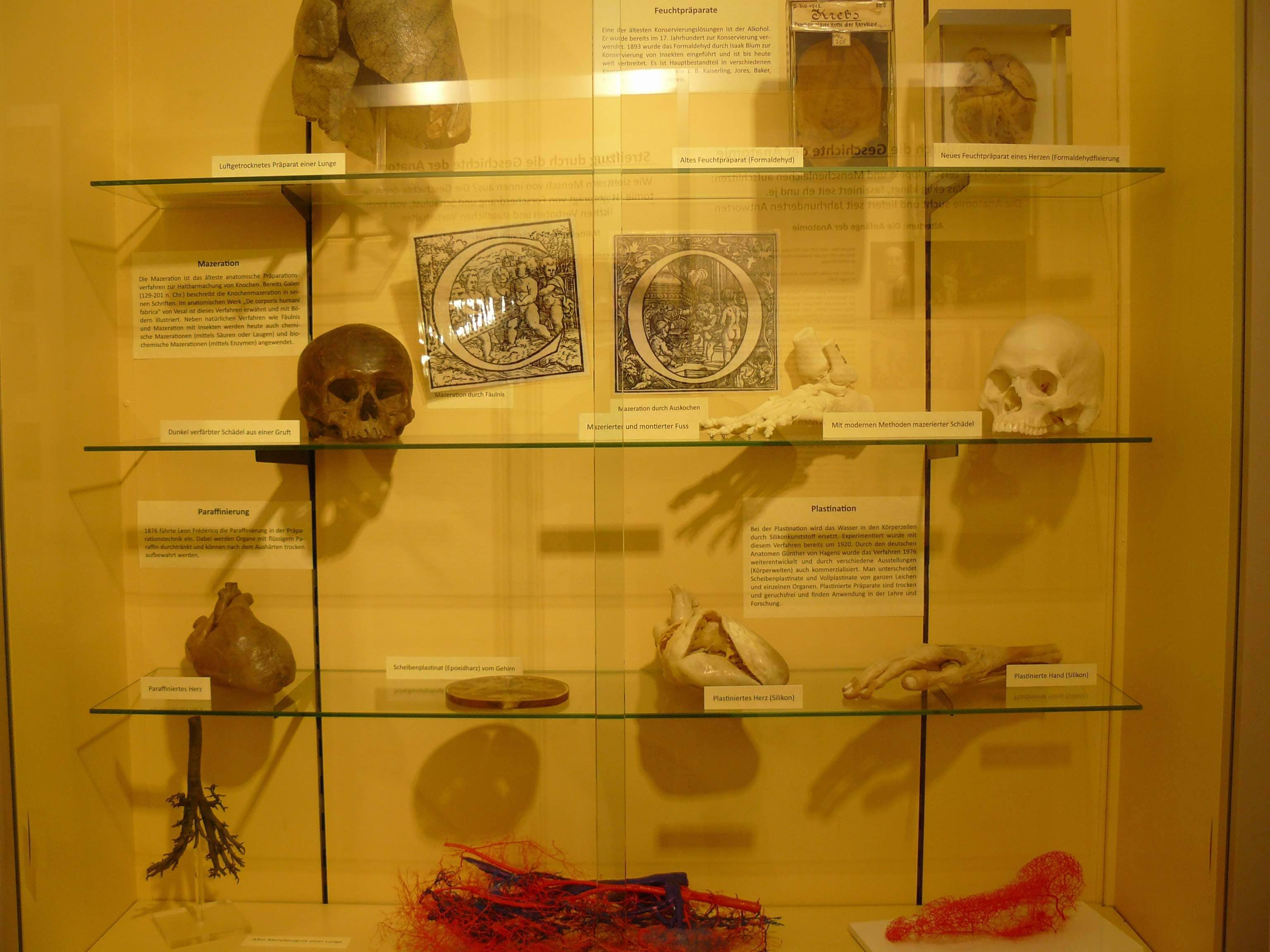 Organ and Tissue Specimens