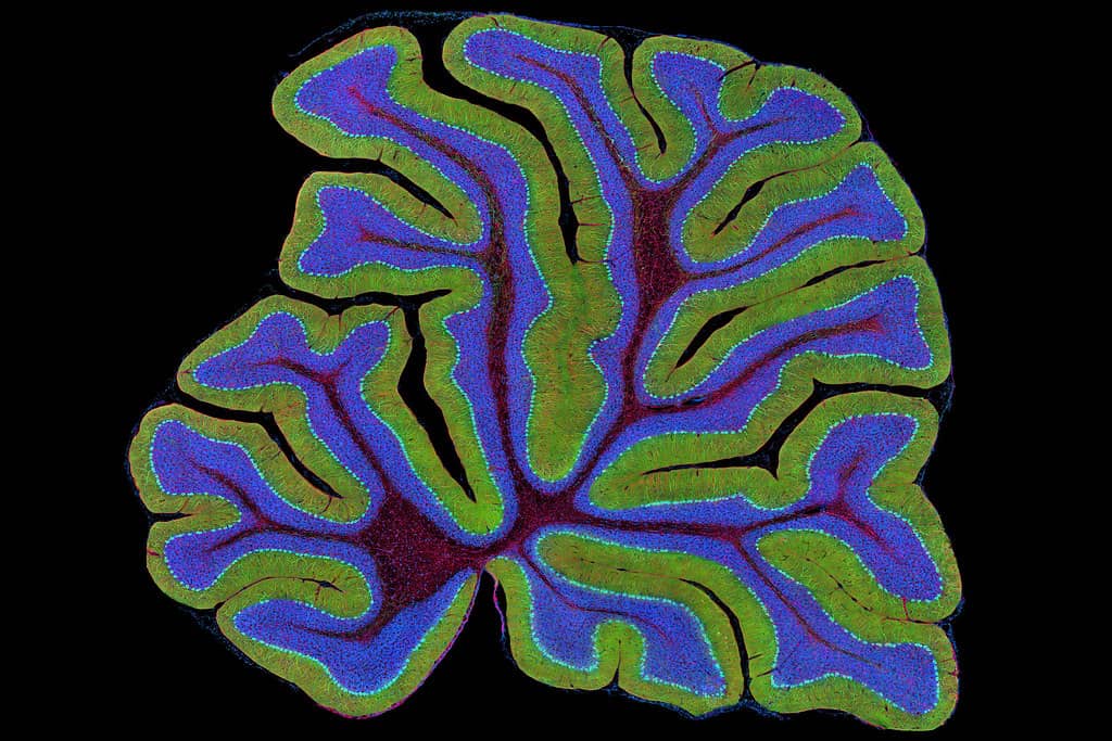 Your Brain Exhibit