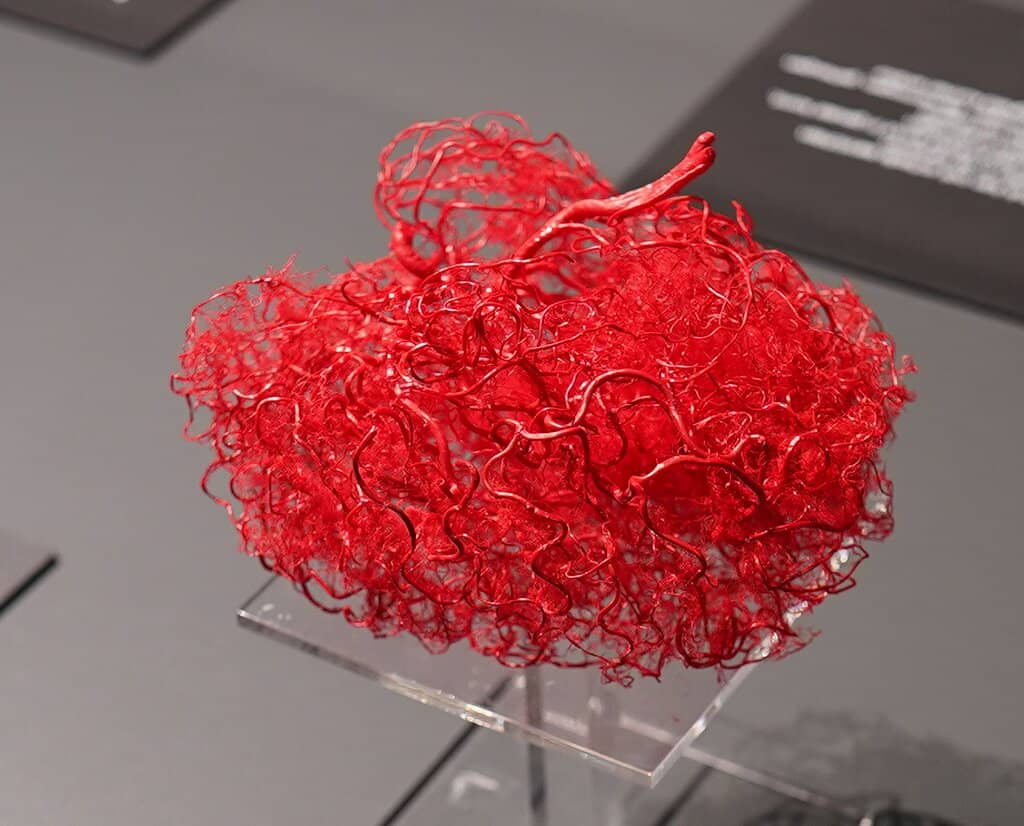 Donor Program Insights