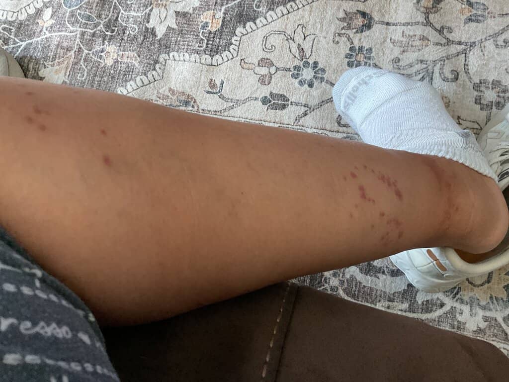 Balandra Hill Viewpoint