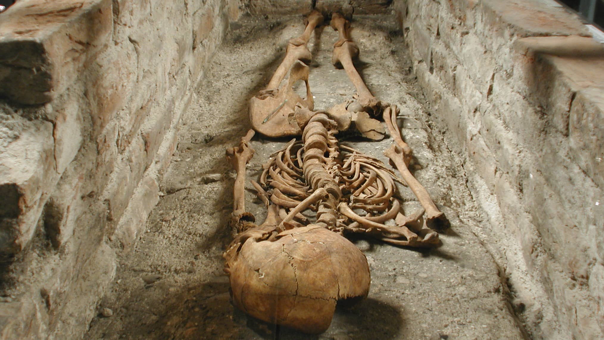 Skeletal Remains