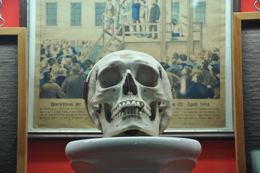 Schädel des Mädchenmörders Hugo Schenk