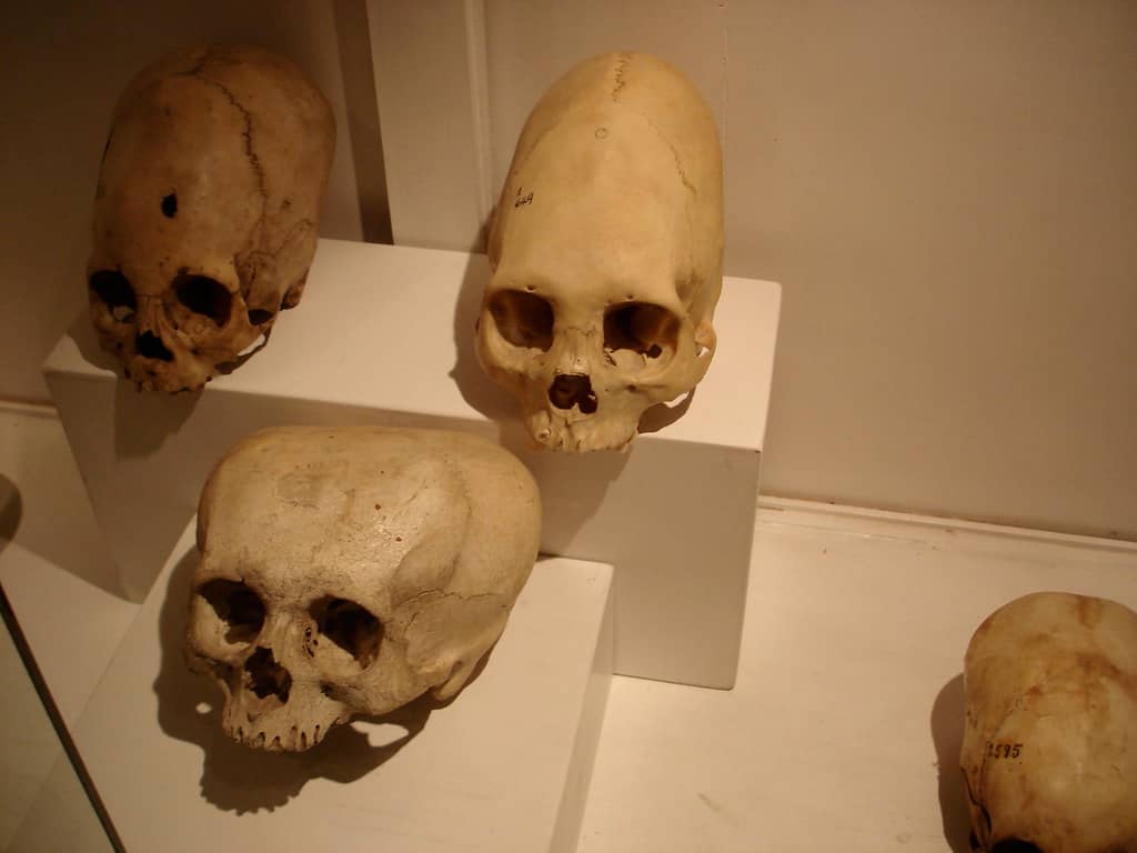 Elongated Skulls