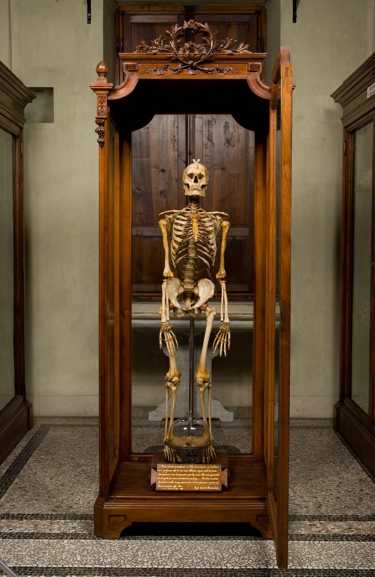 Preserved Specimens & Mummies